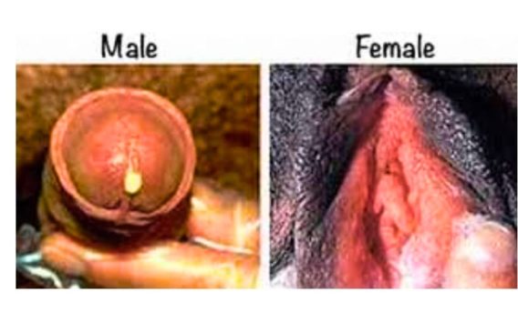 BACTERIAL IMAGE INFEC